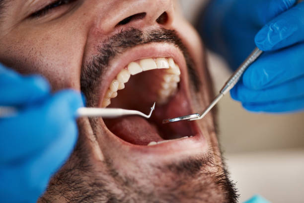 Best Emergency Dental Services for Seniors in Fairfield, TX