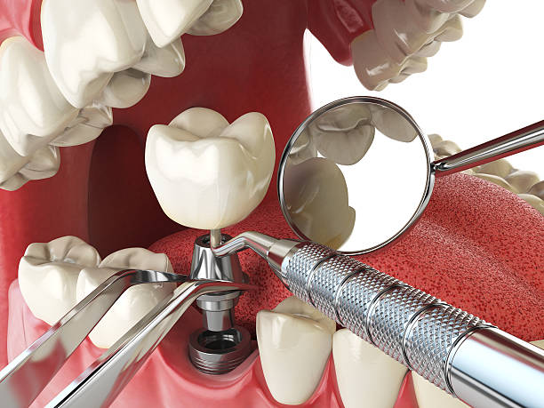 Best Orthodontic Emergency Dentist in Fairfield, TX