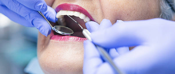 Best Emergency Dentist for Knocked-Out Tooth in Fairfield, TX